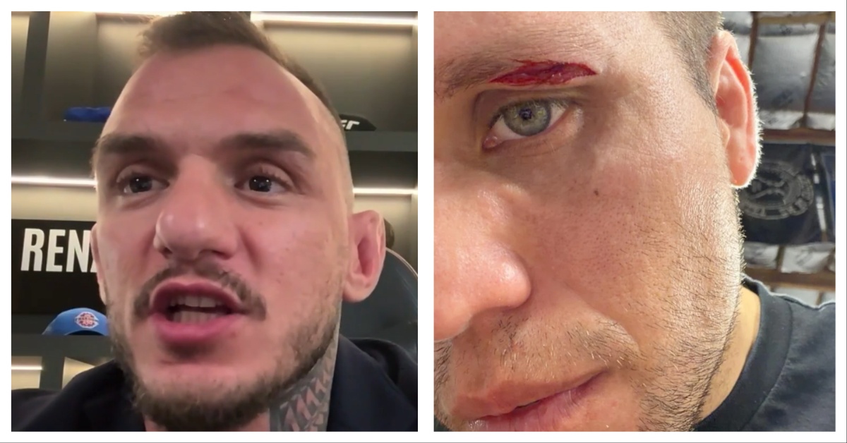 Brian Ortega forfait : 'Pas au top mentalement' — La Moneyline MMA s'affole !