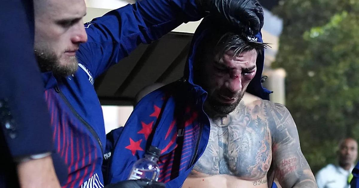 Ilia Topuria Détrôné : L'Impact Stratégique de sa Première Défaite pour les Paris UFC